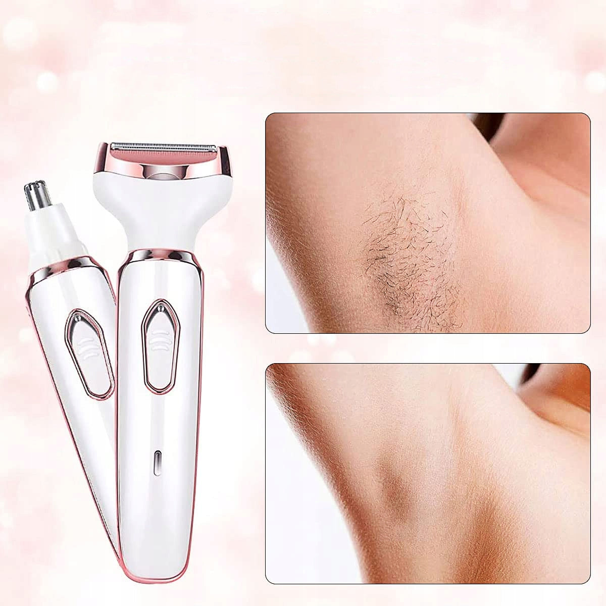 Depilador Elétrico 4 em 1 – Pele Lisinha Sem Dor, Sem Irritação e em Segundos